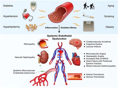 Endothelial Dysfunction Arteriosclerosis Thrombosis And Vascular