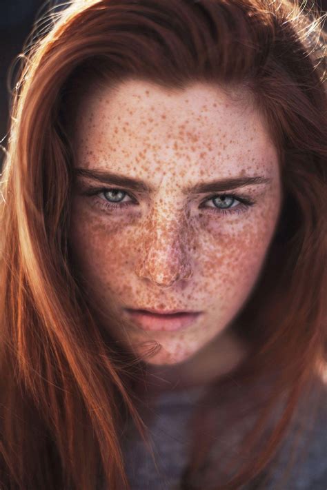I Know Off Topics Are Bad But I Really Think Redheads With Freckles