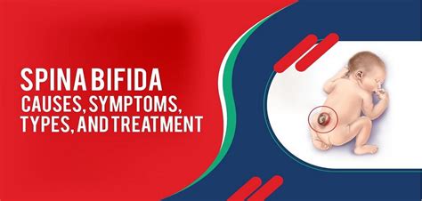 Spina Bifida Causes Symptoms Types And Treatment