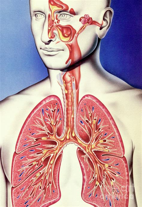 Upper And Lower Respiratory Tract Infections Photograph By John Bavosi