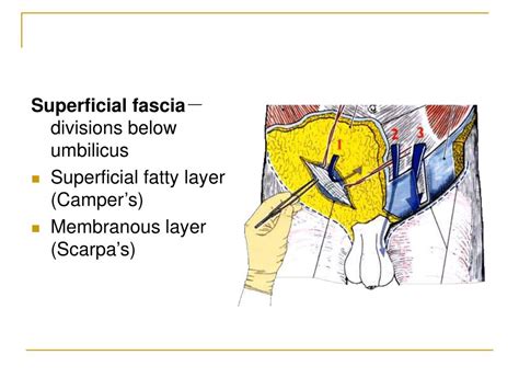 Ppt Abdominal Wall Powerpoint Presentation Free Download Id295293