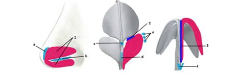 Anatomic Diagram Of The Nasal Tip Support Mechanisms The Major Tip