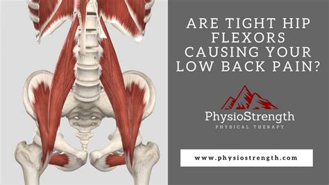 Are Tight Hip Flexors Causing Your Low Back Pain Youtube