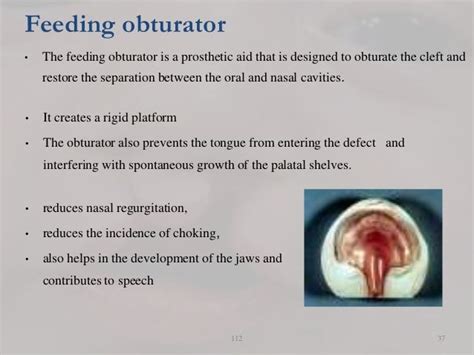 Role Of Orthodontist In Cleft Lip And Palate Management