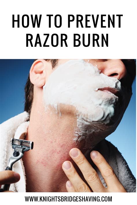 Prevent Razor Burn With These Expert Tips
