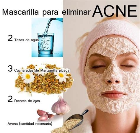Metodos Caseros Para El Acne Remedios Caseros Para El Acne En La Cara