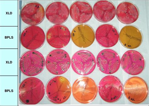 Salmonella Are Shown As Whitish Pink Colonies With Black Centres On
