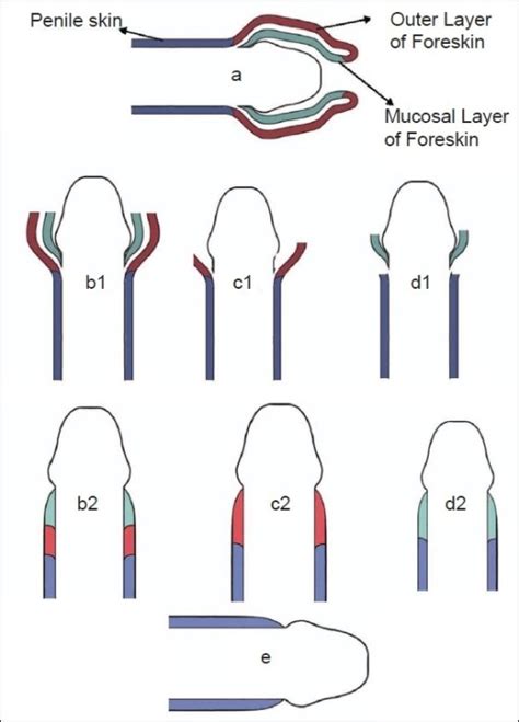 a schematic normal anatomy of uncircumcised human fore open i