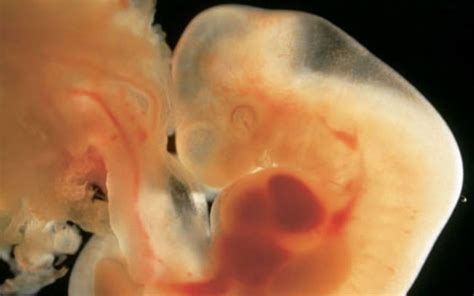Embrión No Es Un Humano Investigador De La Unam Aborto 12 Semanas