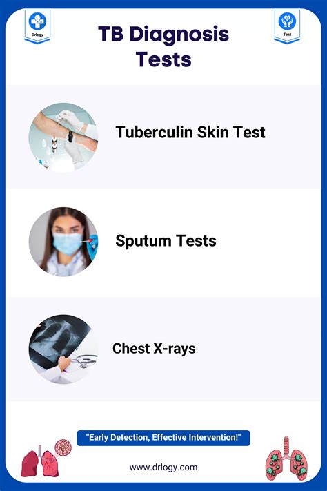 3 Most Accurate TB Diagnosis Test For Early Detection - Drlogy