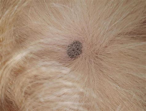 Patois Vol Prématuré Black Spots On Dogs Skin Sont Familiers Conduire Mur