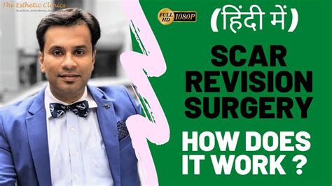 हिंदी मैं Scar Revision Surgery ये सर्जरी कैसे करते है Dr Debraj