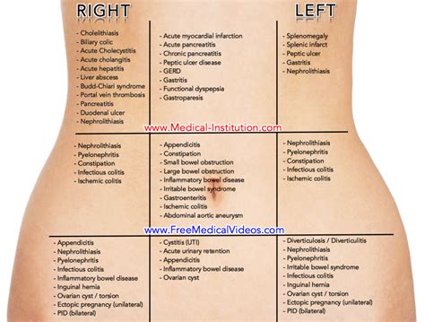 Abdominal Pain Causes By Location Stomach Anatomy And Quadrants Hot