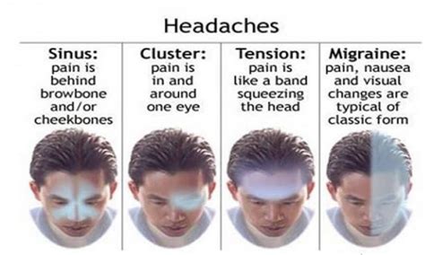 Different Types Of Headaches And Their Significance Neopress