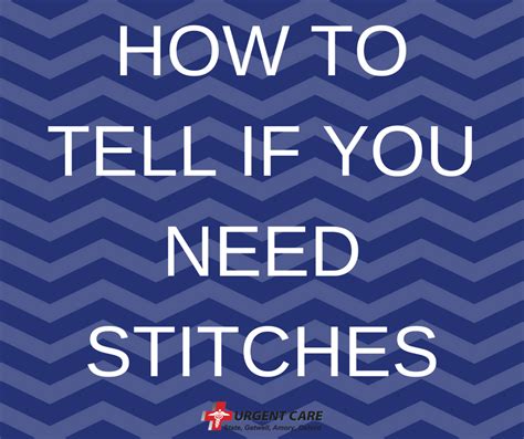 How To Tell If You Need Stitches Urgent Care Mississippi