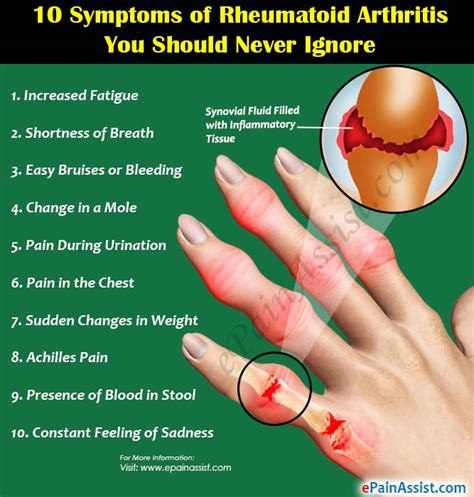 Gout bumps on the fingers bumps, known arthritis in the hands can also be a symptom of rheumatoid arthritis, if. 10 Symptoms of Rheumatoid Arthritis You Should Never Ignore