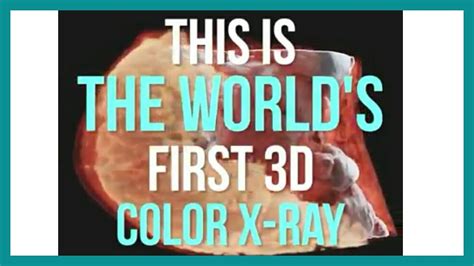 Worlds First 3d Color X Ray Youtube