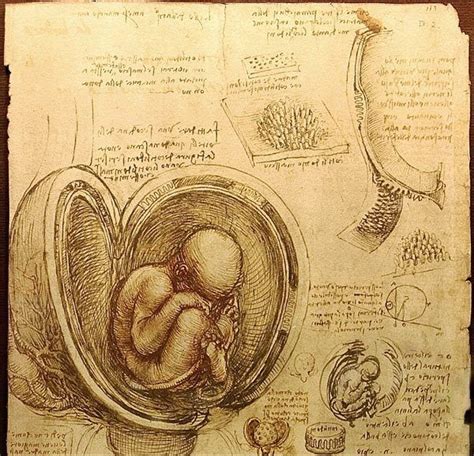 Leonardo Da Vinci—the Dyslexic Genius Leonardo Da Vinci Birth Art Art