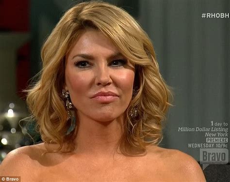 Brandi Glanville Admits Too Many Fillers And Some Bad Botox Daily