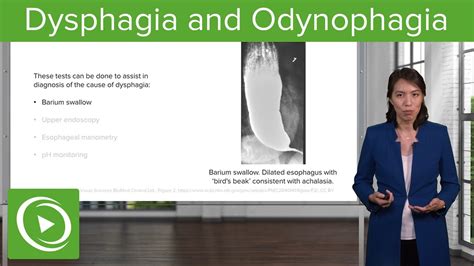 Dysphagia And Odynophagia Disorders Of The Esophagus And The Stomach