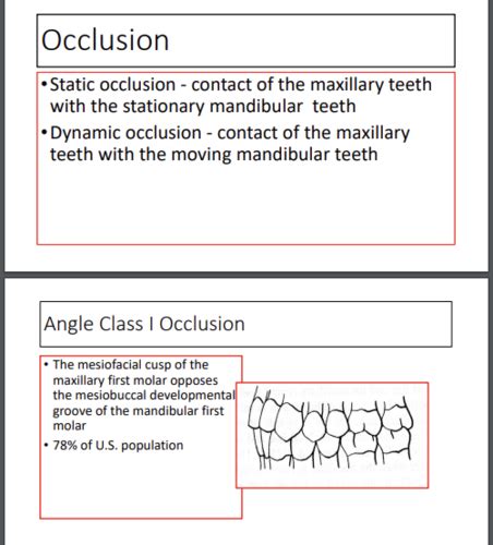 Occlusion Flashcards Quizlet