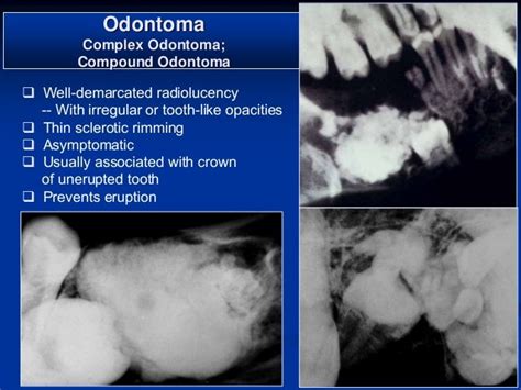Oral And Maxillofacial Pathology Radiology