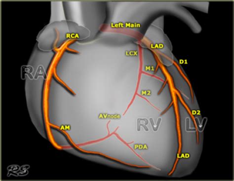 Coronary Arteries Pictures | eNetMD