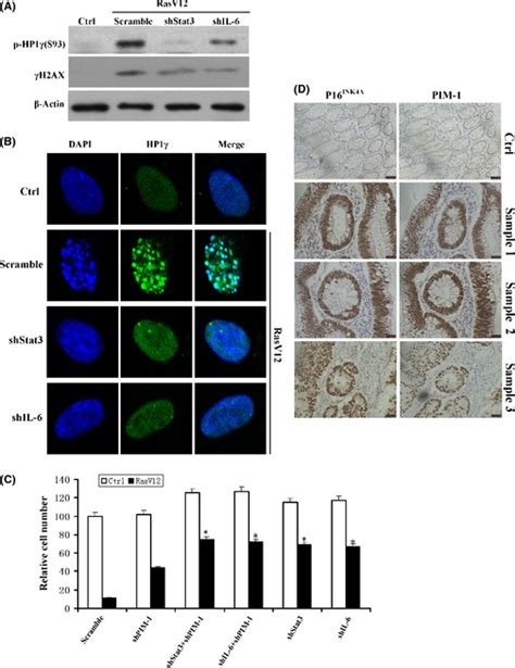 Il 6 Signaling Regulates Hp1γ Phosphorylation And Sahf Formation During