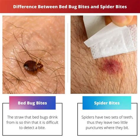 Bed Bug Bites Vs Spider Bites Difference And Comparison