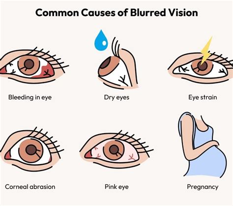 What Causes Blurred Vision Eyebuydirect