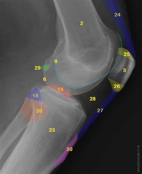 Normal Radiographic Anatomy Of The Knee Distal Femoral Metaphysis Patella Medial