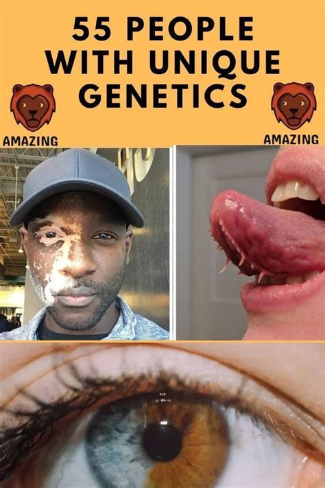 55 People Whose Genetics Make Them Look Incredibly Unique Wow Facts