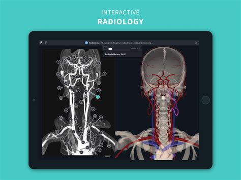 Complete Anatomy ‘21 3d Human Body Atlas For Android Apk Download