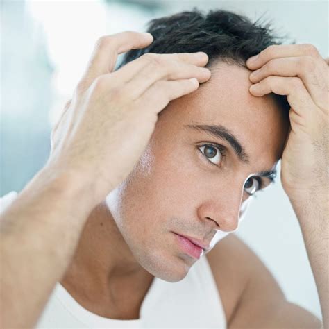 The Different Signs Of Balding At Years Old Mhr Clinic Uk