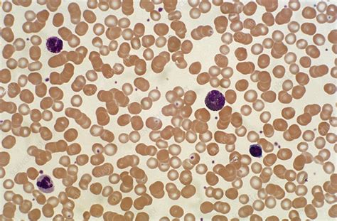 Normal Blood Smear Lm Stock Image C0222202 Science Photo Library