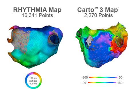 Cardiac Mapping System Rhythmia Hdx Boston Scientific