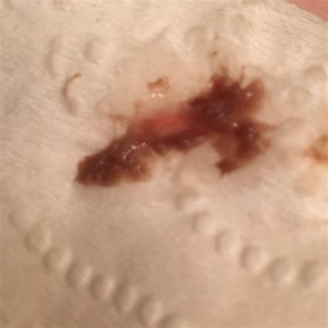 Could Implantation Bleeding Look Like This Sometimes Af Starts Similar