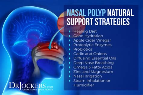 Nasal Polyps Symptoms Causes And Natural Support Strategies