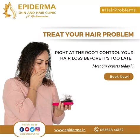 Ppt Treat Your Hair Problem Right At The Root Epiderma Skin And