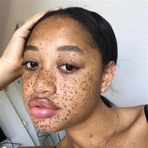 How To Get Freckles With Dark Skin How To Do Thing Images And Photos