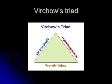 Virchow S Triad