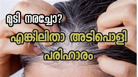 This is a painful process to remove unwanted hair but is a natural one. 100 % Natural Home Remedy For White Hair . - YouTube