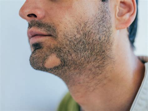 Easy Ways To Jumpstart Your Beard Growth