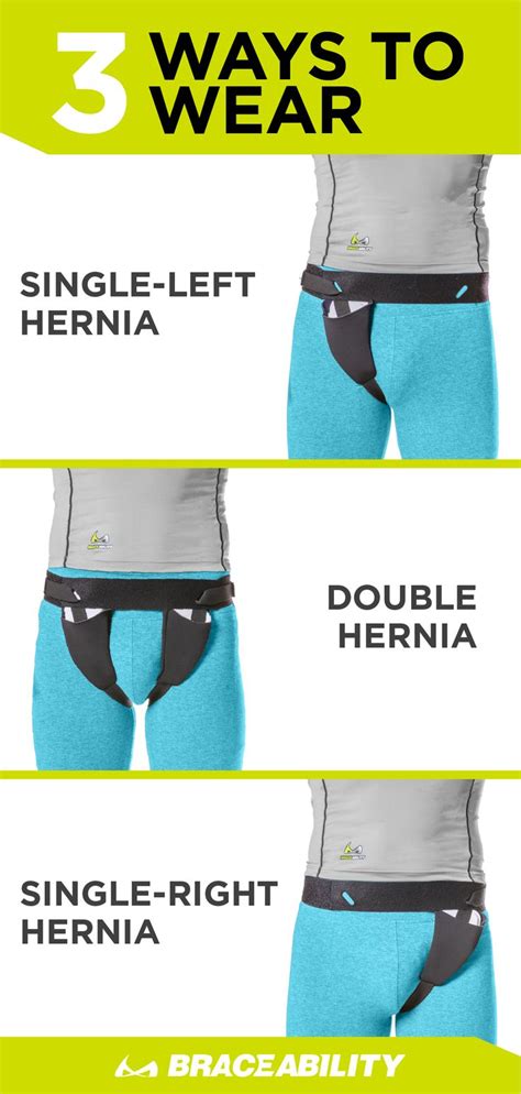 Symptoms may or may not be present in some inguinal hernias. Inguinal Hernia Belt | Groin Support Truss for Bilateral Scrotal & Femoral Hernias in Men or ...