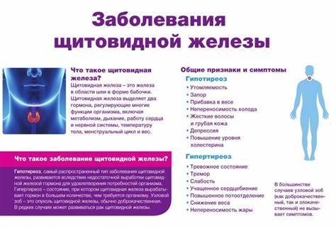 Дисфункция щитовидной железы. Симптомы, указывающие на патологию Картинка - Дисфункция щитовидной железы. Симптомы, указывающие на патологию