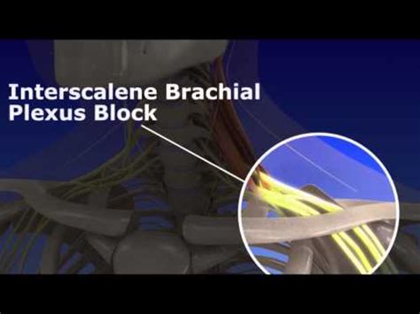 Anaesthesia Cme Anatomy Of Interscalene Block