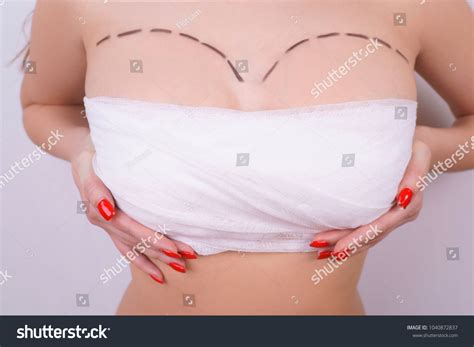 Bandaged Breasts Markings After Plastic Surgery Stock Photo 1040872837