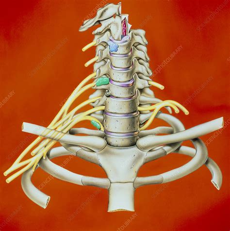 Artwork Of Causes Of Neck Pain In Cervical Spine Stock Image M382