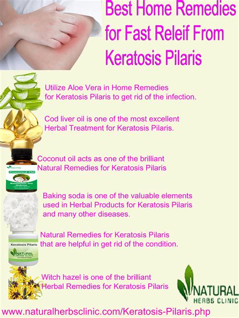 Keratosis Pilaris Natural Treatment Archives Natural Herbs Clinic Blog