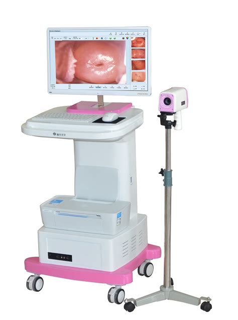 Clinical Vaginal Ccd Camera Portable Electronic Video Colposcope For